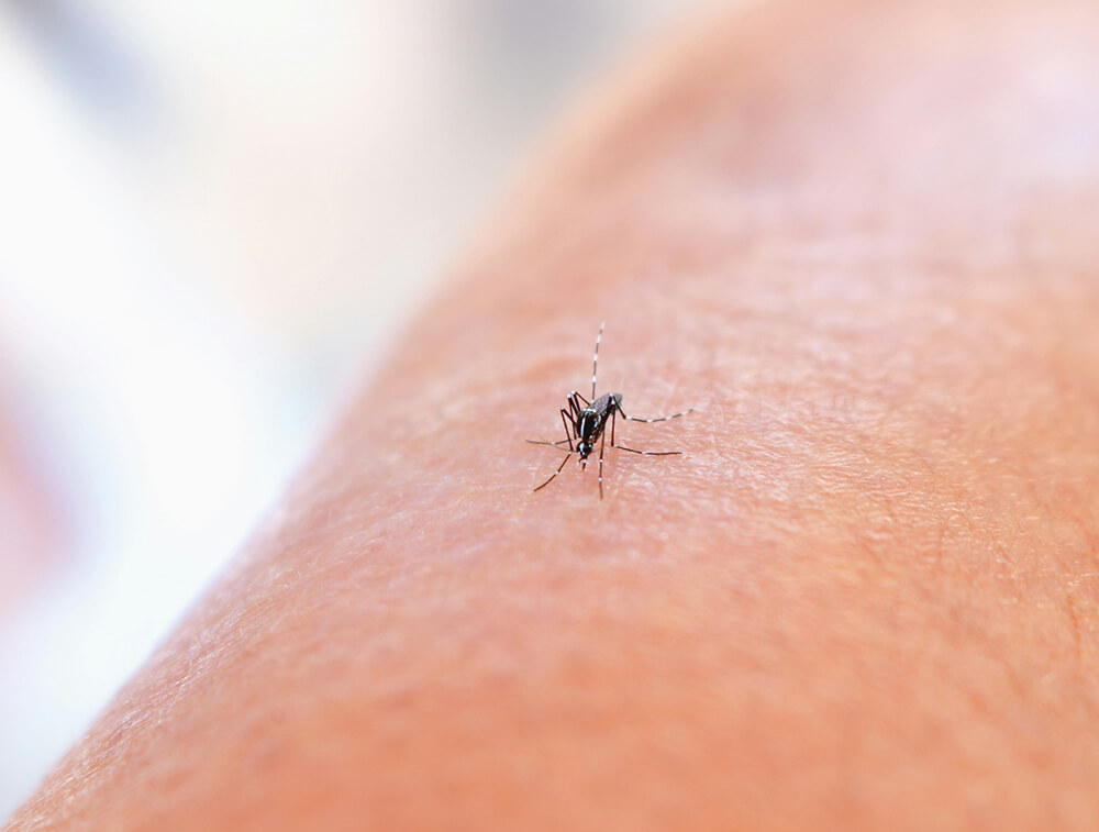 Tupintis odas ant žmogaus odos
